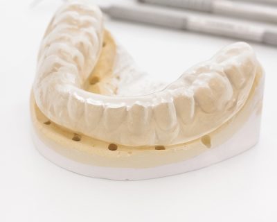 Causes and Treatments of Bruxism