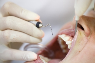 Periodontal Screening in Belmont, MA