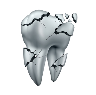 Faqs About Dental Emergencies