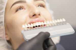 Full-mouth implants in Belmont