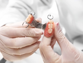 Understanding Fixed Dental Bridges
