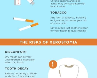 Guide To Xerostomia