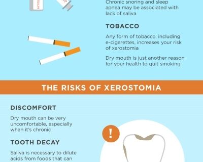 Guide to Xerostomia Infographic