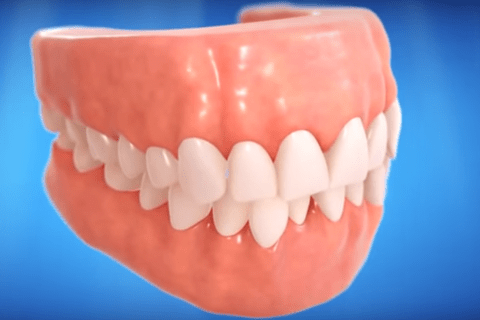 Affect of Crooked Teeth on Oral Health