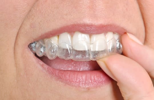 Adjusting to Life with Invisalign