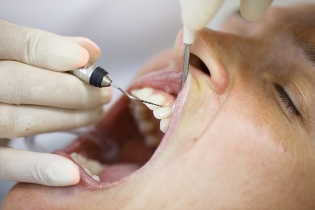 Risk factors associated with receding gums