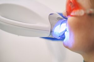 person receiving laser teeth whitening 