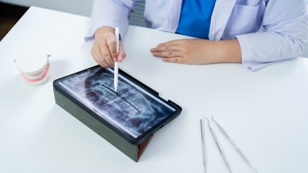 dentist reviewing mouth xray on ipad