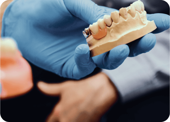 Implant-Supported Dentures