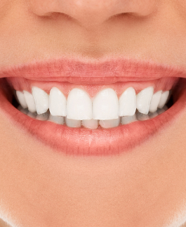 Close-up of a person smiling, showing clean, straight, white teeth and healthy pink gums.