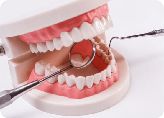 Multiple Teeth Implants