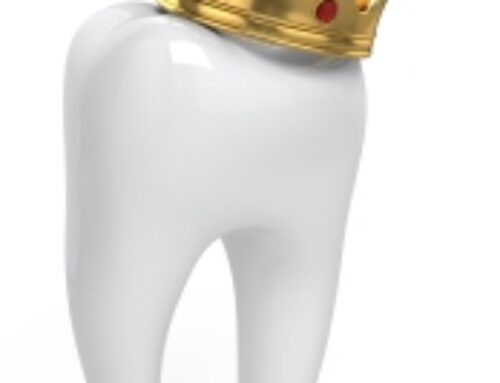 ALL ABOUT DENTAL CROWNS