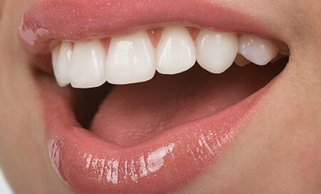 Teeth_1