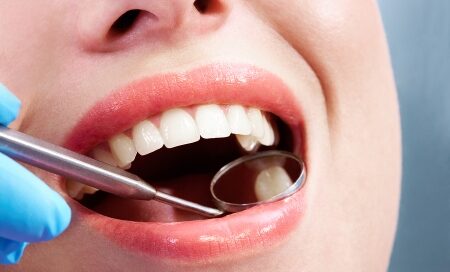 Getting a Cavity Filled