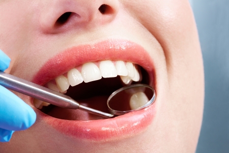 WHAT TO EXPECT WHEN YOU GET A CAVITY FILLED