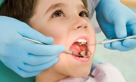 Gum Disease_2