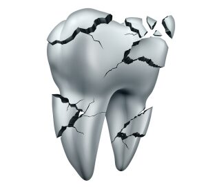 Faqs About Dental Emergencies