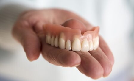 Full Mouth Dental Implant