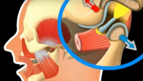 Diagram showing the anatomy of the human ear, with a detailed inset highlighting the inner ear components and the pathway of sound indicated by arrows.
