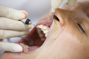 LOOKING AT LOCALIZED GUM RECESSION