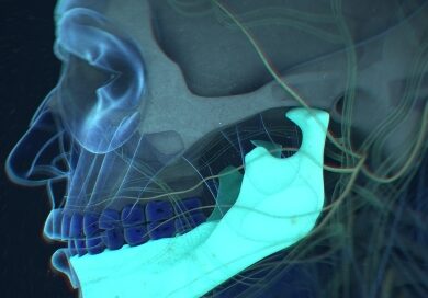 Corrective Treatment For Jawbone Issues By Belmont Dental Group