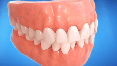 Affect of Crooked Teeth on Oral Health