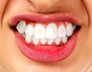 FINDING THE RIGHT TREATMENT FOR BRUXISM SYMPTOMS