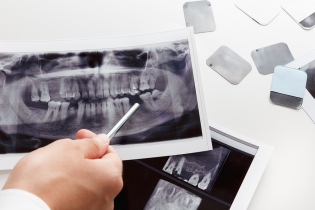 COMMON TREATMENTS FOR GUM AND JAW ISSUES