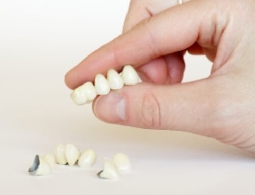 REASONS TO SMILE ABOUT THE COSMETIC BENEFITS OF CROWNS