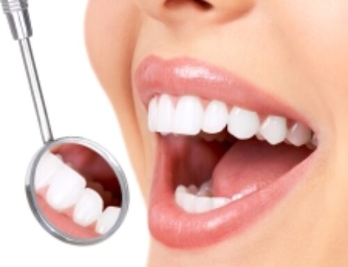 EXPLORING THE ADVANTAGES OF PROFESSIONAL TEETH WHITENING
