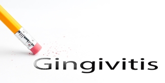 ESSENTIAL INFORMATION ABOUT GINGIVITIS