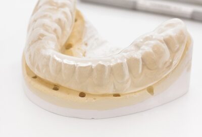 Causes and Treatments of Bruxism