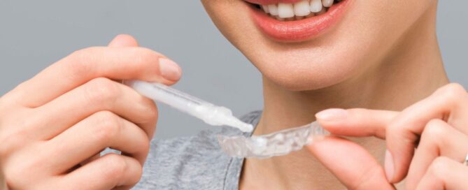 A young woman does a home teeth whitening procedure. Whitening tray with gel.