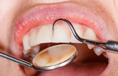 Gum disease treatment center in Belmont, MA