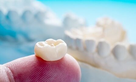 A dental crown is shown on the tip of a person's finger. In the background, an out-of-focus dental model can be seen.
