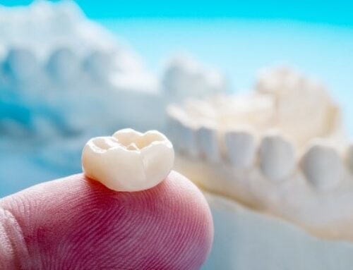What are Dental Crowns