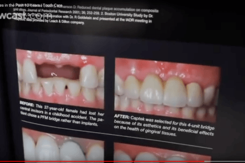 A LOOK AT RECENT DENTISTRY ADVANCES