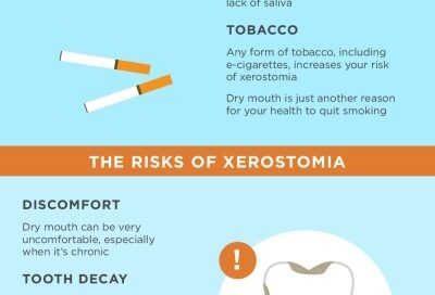Guide to Xerostomia Infographic