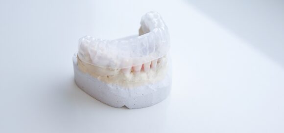 How Invisalign Works