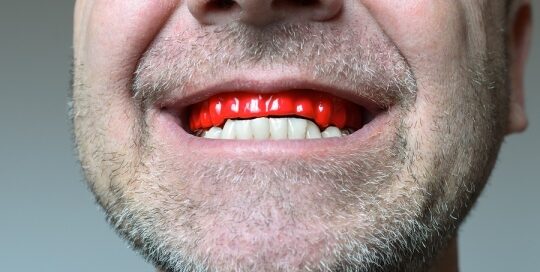 A close-up of a person with a stubbly beard, smiling to reveal red novelty teeth.