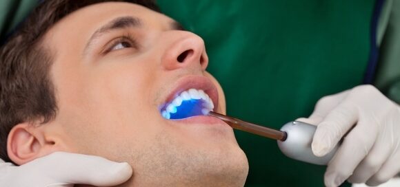 A person receiving dental treatment with a curing light device in a dentist's office.