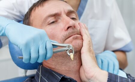 Common Reasons for Tooth Extractions