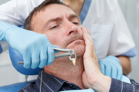 Common Reasons for Tooth Extractions