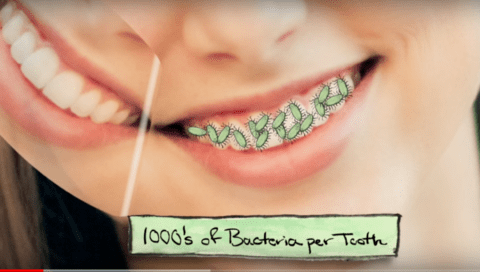 A close-up of a smiling person with a section of their teeth overlaid with green bacteria illustrations. A label reads, "1000's of Bacteria per Tooth.