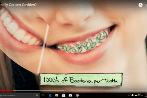 UNDERSTANDING HOW CAVITIES FORM