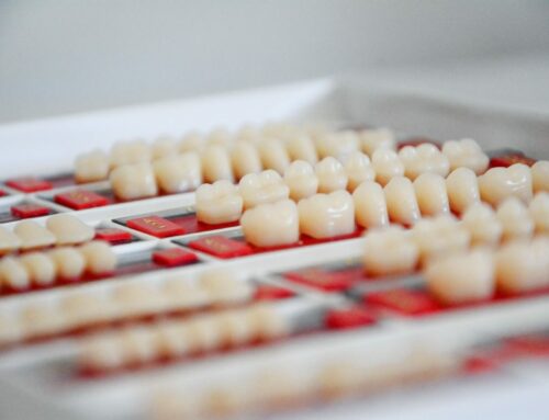 The Ultimate Guide to Porcelain Veneers: Cost, Procedure, and Benefits