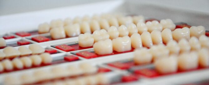 Porcelain Veneers
