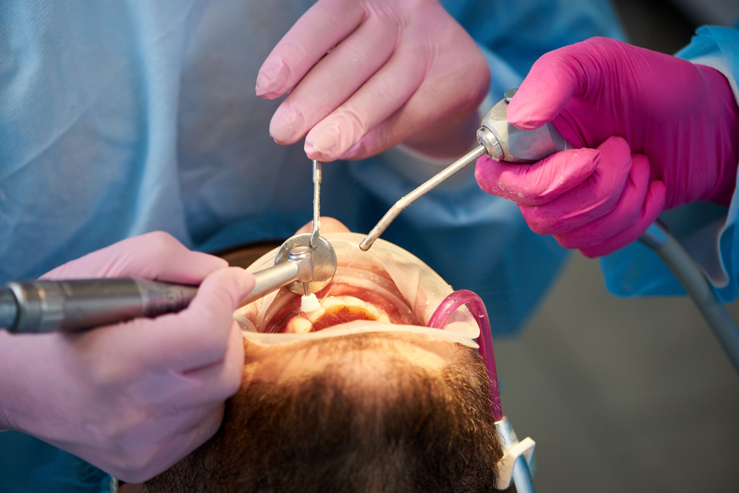 Dentist and assistant performing dental procedure on a patient, using tools and wearing gloves.